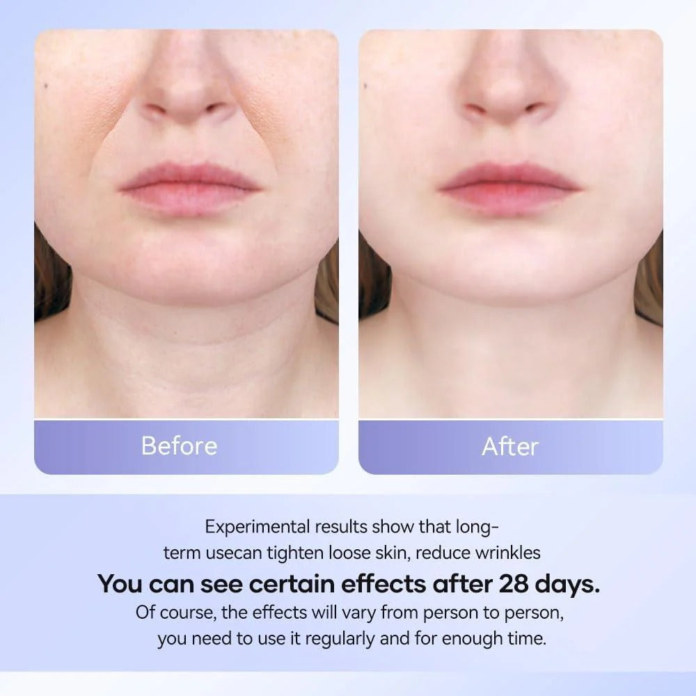 Neck Face Beauty Device