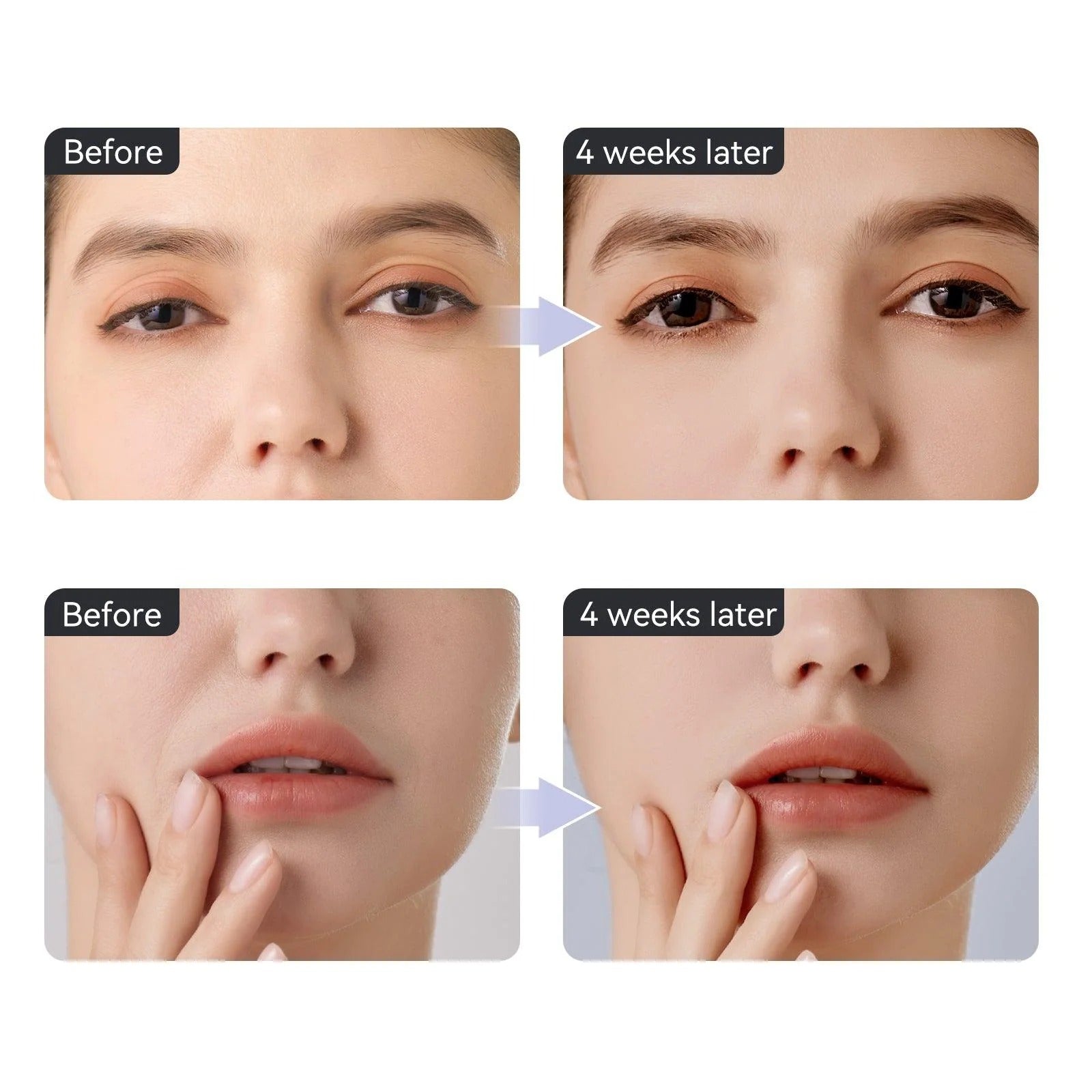 EMS Microcurrent Eye Beauty Device