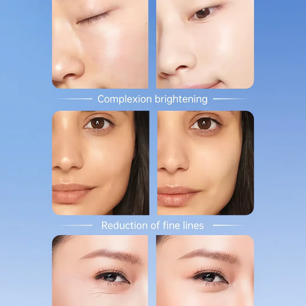 SkinLift – 3-in-1 EMS & Heat Facial Roller
