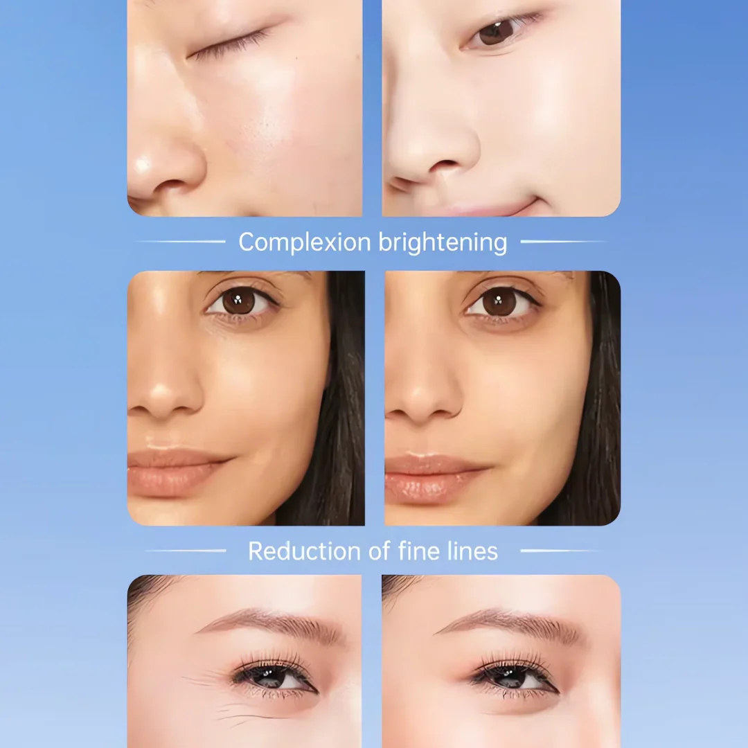 SkinLift – 3-in-1 EMS & Heat Facial Roller