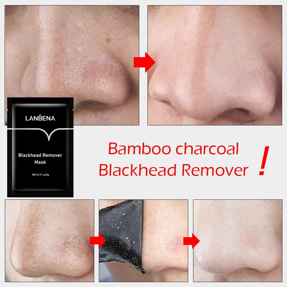 Nose Blackhead Remover